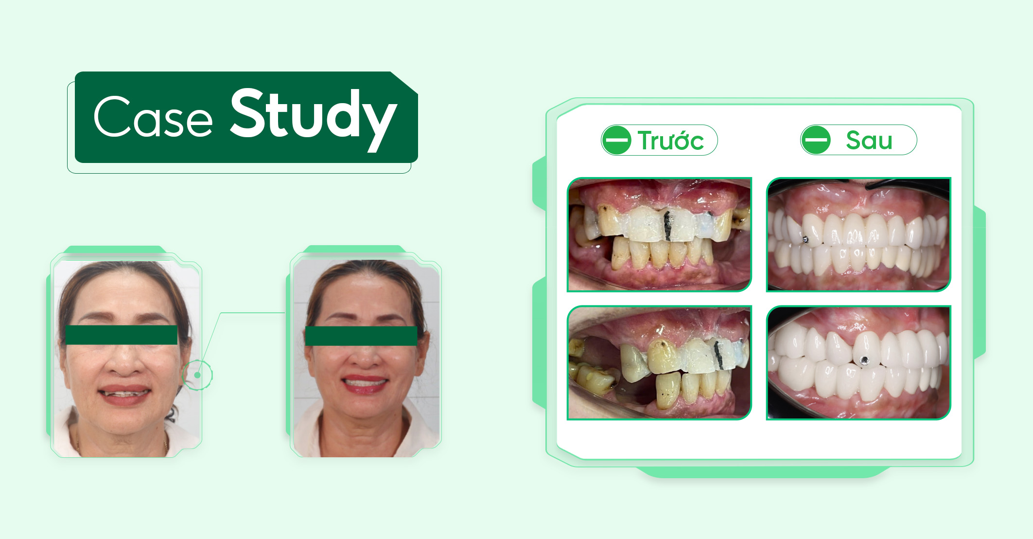 Case-boc-rang-sư ( 1 )