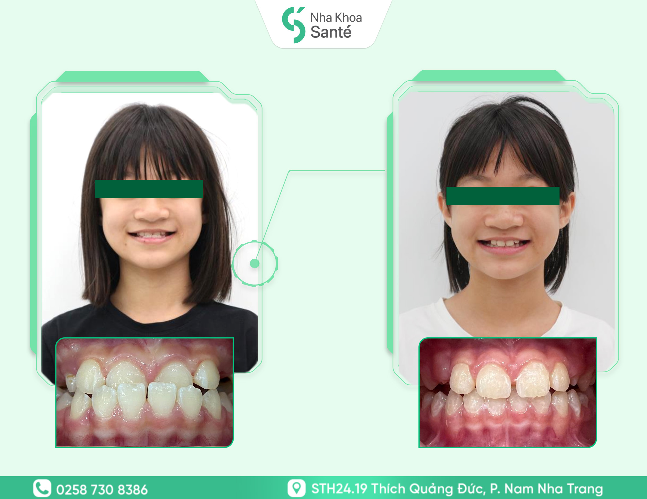 Case-chinh-nha-tang-truong ( 1 )