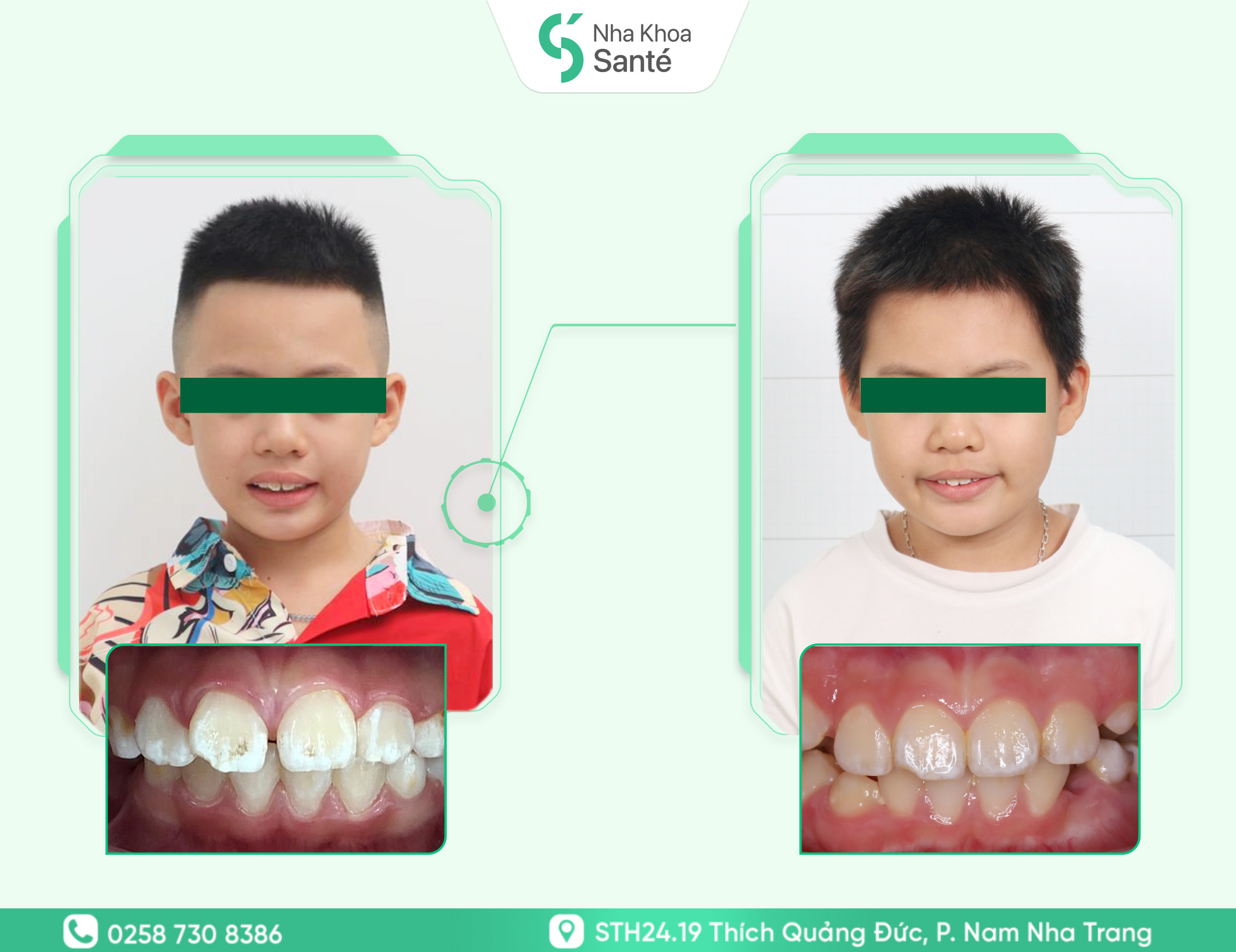 Case-chinh-nha-tang-truong ( 2 )