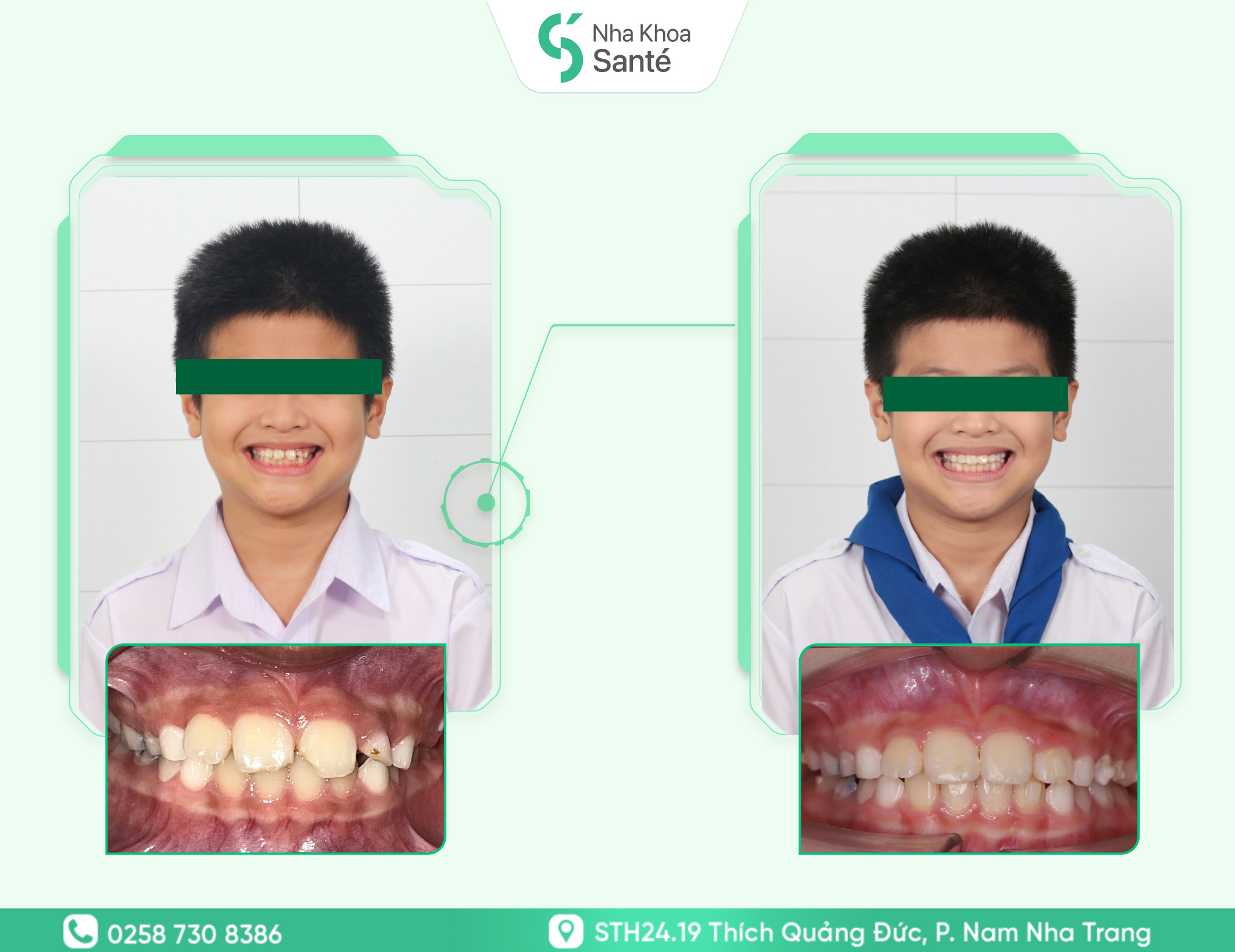 Hoàng Phúc Nguyên - Smartee