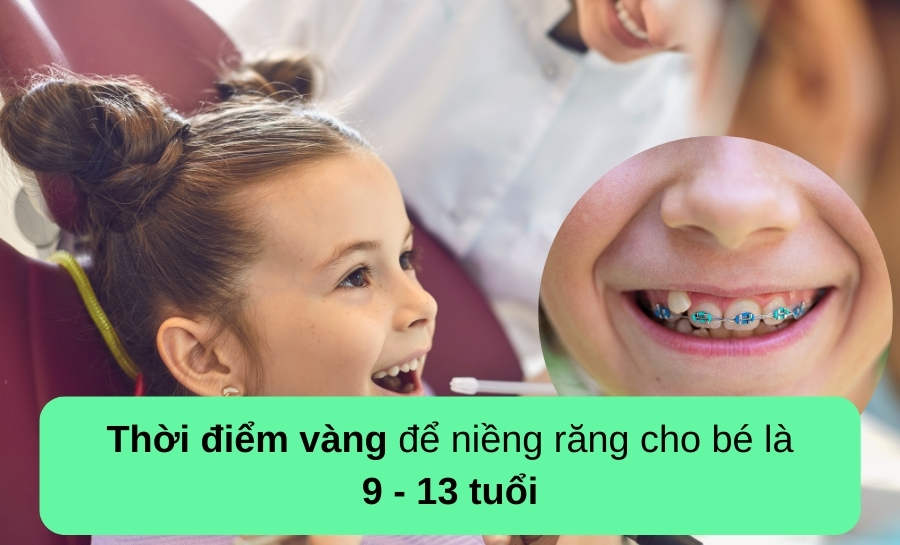 Trẻ Bao Nhiêu Tuổi Niềng Răng Được? Giải Đáp Từ Nha Sĩ