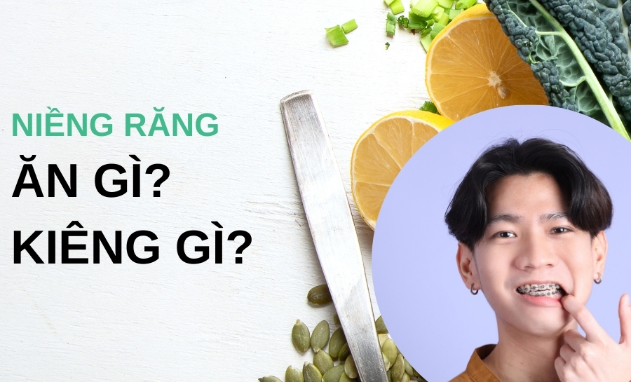 Người Mới Niềng Răng Nên Ăn Gì Và Kiêng Gì?