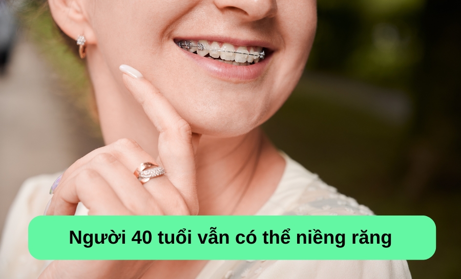 40 Tuổi Có Niềng Răng Được Không? Chuyên Gia Giải Đáp