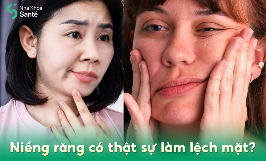 Niềng Răng Bị Lệch Mặt: Nguyên Nhân, Cách Xử Lý Và Lưu Ý Quan Trọng