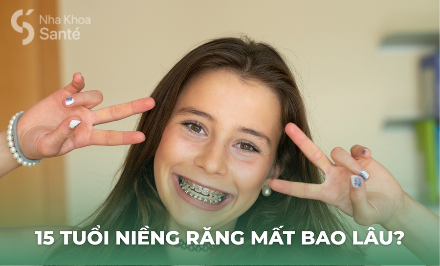 15 Tuổi Niềng Răng Mất Bao Lâu? Thời Gian Hiệu Quả Và An Toàn Nhất