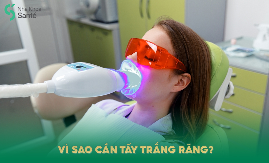 Lưu Ý Trước Và Sau Tẩy Trắng Răng Bạn Cần Biết