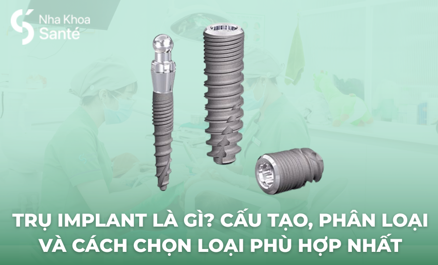 Trụ Implant Là Gì? Cấu Tạo, Phân Loại Và Cách Chọn Loại Phù Hợp Nhất